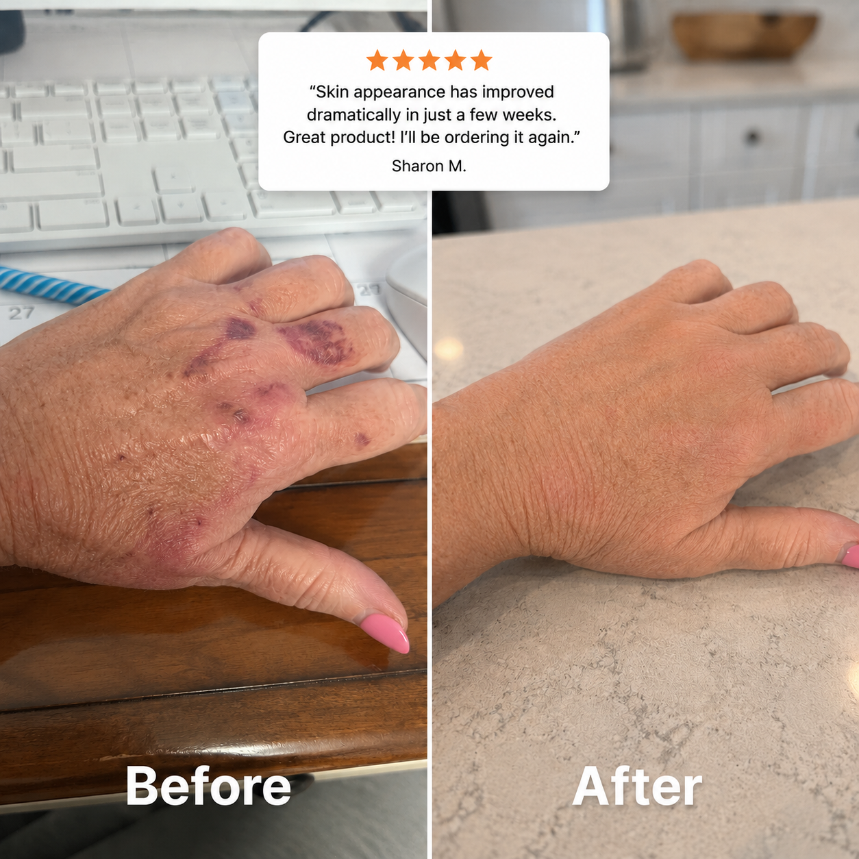 2-1 Moisturizing Bruise Formula